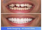 Best Smile Designing Clinic in Vile Parle, Mumbai | AK Dental Clinic