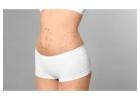 What Body Part is Most Painful to Liposuction?
