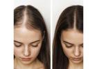 Best Hair Clinic in Noida for Natural Hair Restoration