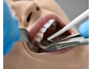 Dental bone graft la