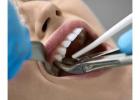 Dental bone graft la