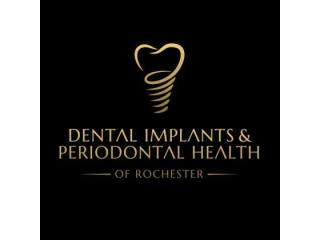 Dental Implants & Periodontal Health