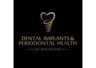 Dental Implants & Periodontal Health