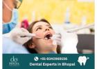 Cosmetic Dental Treatment in Bhopal
