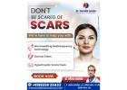 Best Scar Treatment in Rewa – Dr. Saurabh Saxena