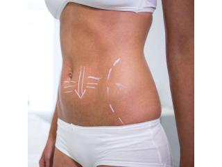 Best Body Sculpting Surgery in San Francisco