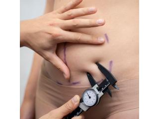 Advanced Non Surgical Tummy Fat Removal
