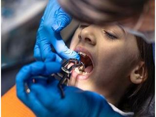 Best Dental Implants Dublin – Expert Care at Merrion Square Dental