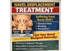 Expert Navel Displacement Treatment for Safe & Natural Recovery