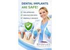Secure Your Smile Safely with Dental Implants