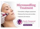 Microneedling Surrey for Smooth, Radiant Skin | Purely Pampered