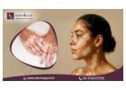 Best Vitiligo Treatment in Bangalore by Expert Dermatologists - Dermaqure
