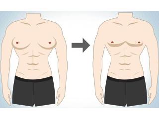 Advanced Gynecomastia Surgery in Mumbai - Get Natural Results