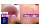 Professional Laser Birthmark Removal in Thane | DNA Royal Clinic.