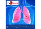  Best Lung Cancer Treatment in Ahmedabad – Dr. Mihir Shah