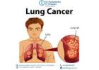 Personalized Lung Cancer Treatment in Ahmedabad with Modern Therapies