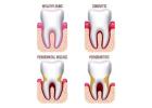 Professional Gum Disease Treatment in Oklahoma City at Dana Price Dental