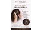 Hair thinning or visible scalp can affect confidence!
