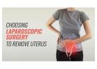 Laparoscopic surgery to remove uterus in bangalore | Worldofurology