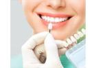 What Is the Difference Between Single Tooth Implants, Implant Bridges, and All-on-4