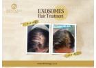 Boost Hair Growth with Exosome Therapy in Indore