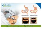 Expert Bariatric Surgery for Weight Loss in Bangalore - Dr. Lohith Gastrosurgeon