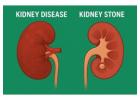 Kidney Disease vs. Kidney Stones: Key Differences and Right Specialist