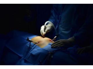 Best Laparoscopic Surgeon in Kolkata – Dr. Purnendu Roy
