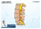 Canal Stenosis Treatment in Ahmedabad | Spine Specialist Ahmedabad