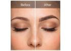Microblading Eyebrows: How Microblading Enhances Natural Brow Shape