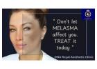Best Melasma Treatment in Thane by DNA Royal Skin Experts.