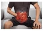 Intestinal Problems Doctor Gujarat – Dr. Jigar Patel   