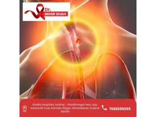 Top Esophageal Cancer Treatment in Ahmedabad – Dr Mihir Shah