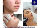 Affordable Laser Resurfacing Treatment in Thane at DNA Royal.