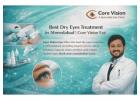 Get Relief with Best Dry Eyes Treatment in Ahmedabad