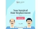 man hair replacement 