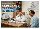 Skin Cancer Treatment In Noida | Modern Cancer Solutions at Zeeva