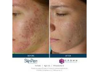 Ultimate Best Treatments for Your Skin Chicago Glow