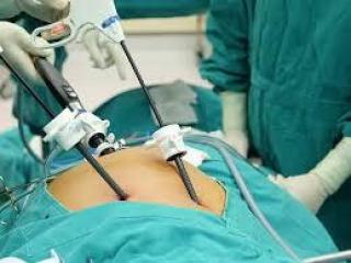 Best Laparoscopic Surgeon in Kolkata for Safe Surgery