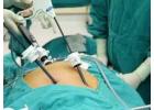 Best Laparoscopic Surgeon in Kolkata for Safe Surgery  