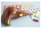 Advanced Cirrhosis Treatment Specialist Ahmedabad  
