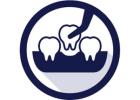 Dental Implants NYC | Full Mouth, All-on-4 & Same-Day Implants
