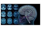 Functional MRI Brain Mapping in Mumbai - Picture This 