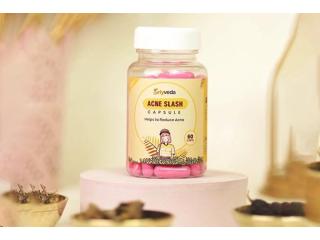 Top Ayurvedic Acne Capsules for Pimples & Clear Skin Naturally