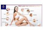 DNA Royal: Your Destination for the Best Laser Hair Removal in Thane.