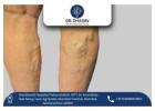 Comfort-Focused Varicose Veins Care in India by Dr. Dharav Kheradia
