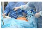 Skilled Laparoscopic Surgeon in Kolkata – Dr. P Roy  