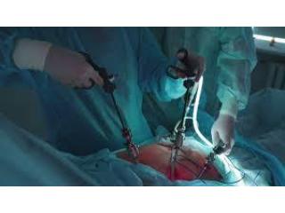 Best Doctor for Gallbladder Stone Surgery in Kolkata