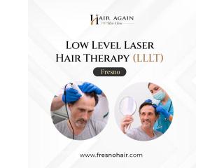 Low Level Laser Hair Therapy