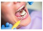 Expert Gum Grafting in Beverly Hills for Healthier, Stronger Gums